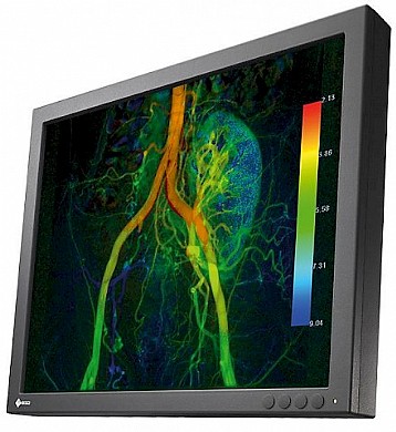 מסך לחדרי ניתוח "27 Eizo CuratOR EX190 מסך לחדרי ניתוח "27 Eizo CuratOR EX190