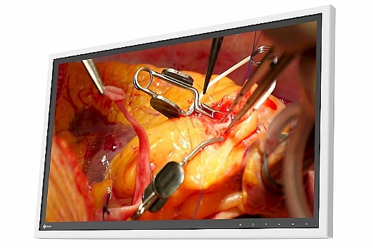 ��� ����� ����� "27 Eizo RadiForce EX271W