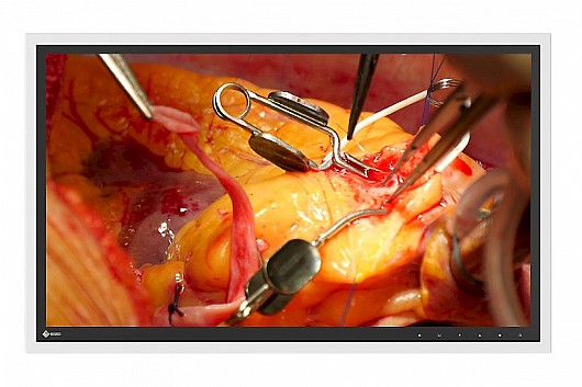 ��� ����� ����� "27 Eizo RadiForce EX271W