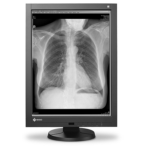 ��� ����� "21.3 Eizo RadiForce GX340