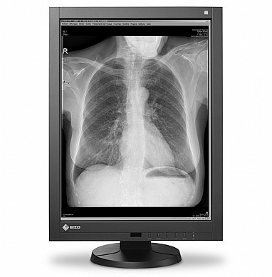 מסך רפואי "21.3 Eizo RadiForce GX340 מסך רפואי "21.3 Eizo RadiForce GX340