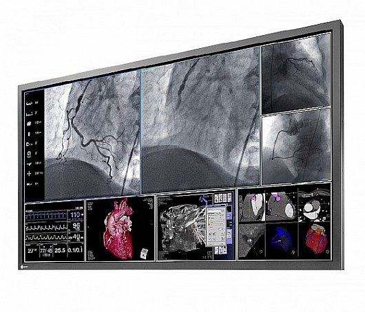 ��� ����� ����� "58 Eizo RadiForce LS580W
