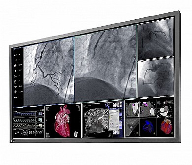 ��� ����� ����� "58 Eizo RadiForce LS580W