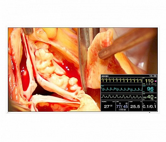 ��� ����� ����� "49 Eizo CuratOR LX491W