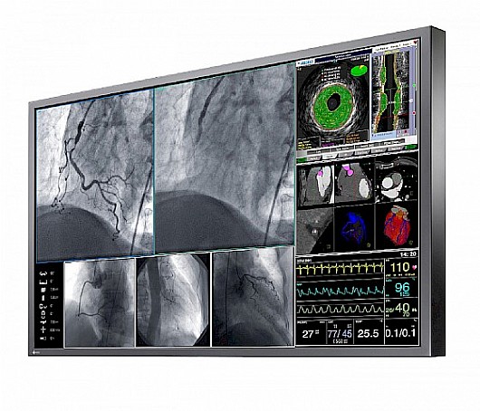 ��� ����� ����� "60 Eizo RadiForce LX600W