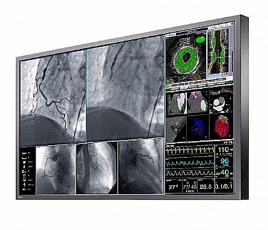 ��� ����� ����� "60 Eizo RadiForce LX600W