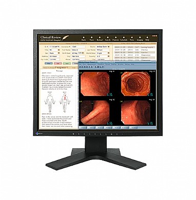 מסך רפואי "19 Eizo RadiForce MX191 מסך רפואי "19 Eizo RadiForce MX191