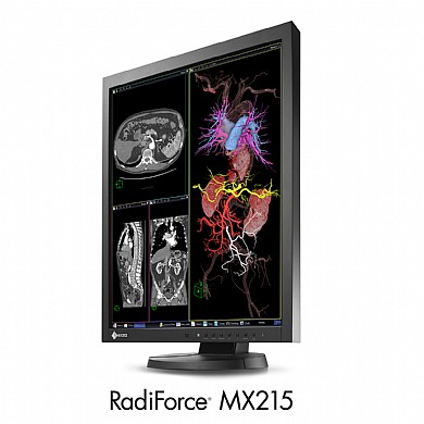 מסך רפואי "21.3 Eizo RadiForce MX215 מסך רפואי "21.3 Eizo RadiForce MX215