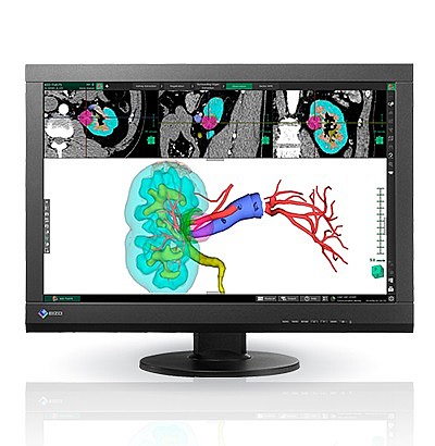 �� ����� "24.1 Eizo RadiForce MX242W 