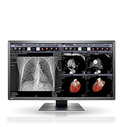 �� ����� "31.1 Eizo RadiForce MX315W 