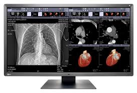 צגים רפואיים